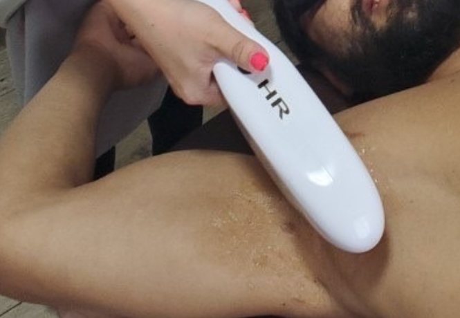 最先端のマシンで施術中