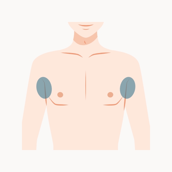 両わきイラスト