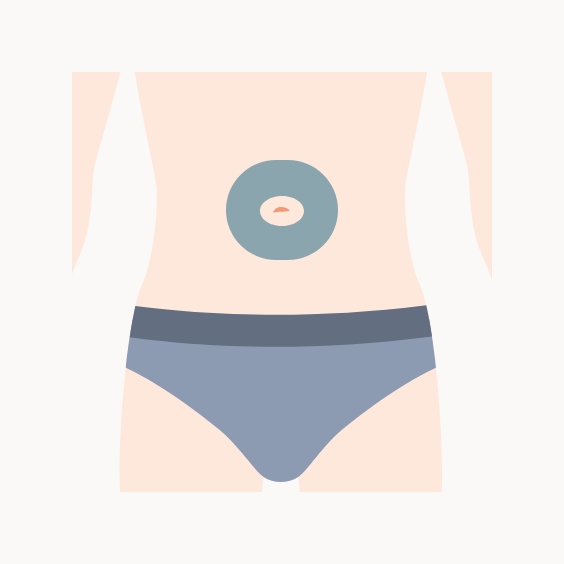 へそ周りイラスト